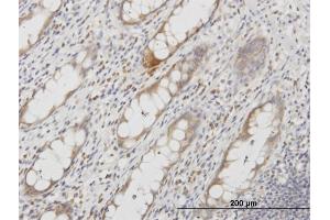 Immunoperoxidase of monoclonal antibody to AQP8 on formalin-fixed paraffin-embedded human colon. (Aquaporin 8 antibody  (AA 1-255))