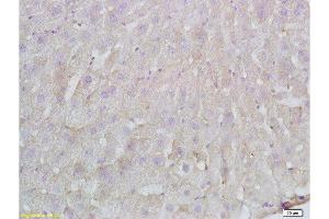 Formalin-fixed and paraffin embedded Rat liver labeled with Anti-FBN1/fibrillin 1 Polyclonal Antibody, Unconjugated  at 1:200 followed by conjugation to the secondary antibody and DAB staining.