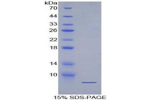 SDS-PAGE (SDS) image for Natriuretic Peptide A (NPPA) (AA 25-152) protein (His tag,GST tag) (ABIN1078933)