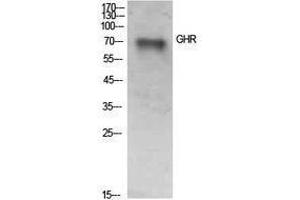 Western Blotting (WB) image for anti-Growth Hormone Receptor (GHR) (Internal Region) antibody (ABIN3181426) (Growth Hormone Receptor antibody  (Internal Region))