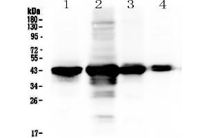Western blot analysis of PON1 using anti-PON1 antibody . (PON1 antibody  (AA 30-274))