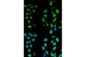 Immunofluorescence analysis of HeLa cells using NFKBIA antibody (ABIN5998339). (NFKBIA antibody)