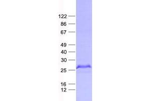 Validation with Western Blot (HAUS2 Protein (His tag))