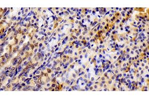 Detection of STAT6 in Rat Stomach Tissue using Polyclonal Antibody to Signal Transducer And Activator Of Transcription 6 (STAT6) (STAT6 antibody  (AA 557-841))