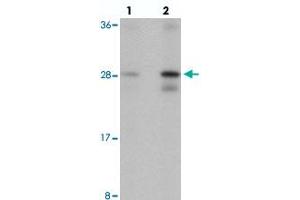 Western blot analysis of SPATA3 in mouse lung tissue with SPATA3 polyclonal antibody  at (lane 1) 1 and (lane 2) 2 ug/mL. (SPATA3 antibody  (C-Term))