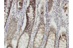 Immunoperoxidase of monoclonal antibody to DMTF1 on formalin-fixed paraffin-embedded human colon. (DMP1 antibody  (AA 661-760))