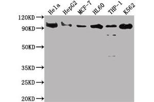 Western Blot Positive WB detected in: Hela whole cell lysate, HepG2 whole cell lysate, MCF-7 whole cell lysate, HL60 whole cell lysate, THP-1 whole cell lysate, K562 whole cell lysate All lanes: SUZ12 antibody at 1:2000 Secondary Goat polyclonal to rabbit IgG at 1/50000 dilution Predicted band size: 84 kDa Observed band size: 90 kDa (Recombinant SUZ12 antibody)