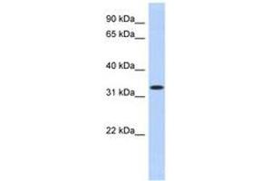 Image no. 1 for anti-metallophosphoesterase Domain Containing 2 (MPPED2) (AA 35-84) antibody (ABIN6743083) (MPPED2 antibody  (AA 35-84))