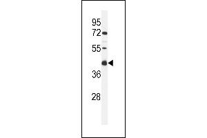 Western blot analysis of C Antibody (C-term) (ABIN653956 and ABIN2843176) in MCF-7 cell line lysates (35 μg/lane). (C9ORF91 antibody  (C-Term))