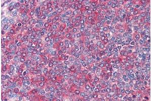Spleen: Formalin-Fixed, Paraffin-Embedded (FFPE) (FZD7 antibody  (AA 559-572))