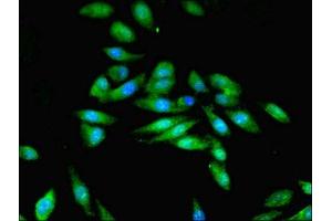 Immunofluorescent analysis of Hela cells using ABIN7168993 at dilution of 1:100 and Alexa Fluor 488-congugated AffiniPure Goat Anti-Rabbit IgG(H+L) (STK33 antibody  (AA 231-514))