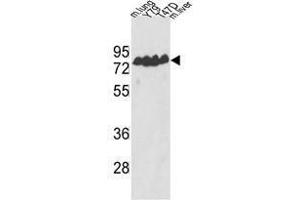 Image no. 1 for anti-Endothelin-Converting Enzyme 1 (ECE1) (Middle Region) antibody (ABIN452931) (ECE1 antibody  (Middle Region))