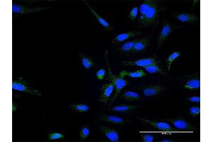 Immunofluorescence of purified MaxPab antibody to ZFYVE16 on HeLa cell. (ZFYVE16 antibody  (AA 1-809))