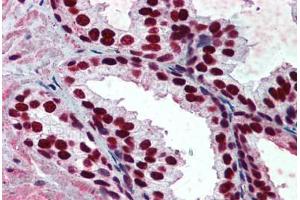 Human Prostate: Formalin-Fixed, Paraffin-Embedded (FFPE) (PHAP1 antibody  (AA 1-250))