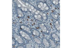 Immunohistochemical staining (Formalin-fixed paraffin-embedded sections) of human small intestine with KIT monoclonal antibody, clone CL1657  shows strong immunoreactivity in a subset of lymphoid cells (macrophages). (KIT antibody  (AA 50-190))