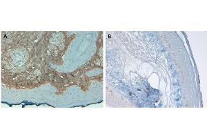 Immunohistochemistry (IHC) image for anti-Collagen, Type I, alpha 1 (COL1A1) antibody (Biotin) (ABIN5596821)