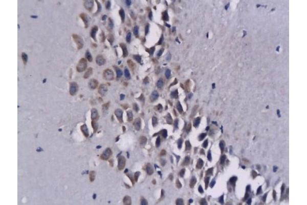 CXCL16 antibody  (AA 85-200)