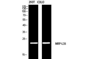Western Blot (WB) analysis of 293T COLO205 using MRP-L35 antibody. (MRPL35 antibody)