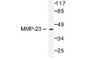 Image no. 1 for anti-Matrix Metallopeptidase 23 (MMP23) antibody (ABIN265530) (Matrix Metallopeptidase 23 (MMP23) antibody)