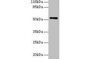 Western blot All lanes: CCDC14 antibody at 2 μg/mL + Jurkat whole cell lysate Secondary Goat polyclonal to rabbit IgG at 1/10000 dilution Predicted band size: 107, 84, 89, 52, 102 kDa Observed band size: 52 kDa (CCDC14 antibody  (AA 159-440))