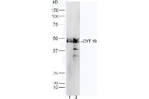 Line1, mouse heart lysate; Line2, mouse liver lysate probed with Rabbit Anti-CYT19 Polyclonal Antibody, Unconjugated (ABIN2559676) at 1:300 in 4˚C. (AS3MT antibody  (AA 21-120))