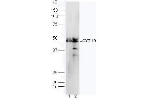 Line1, mouse heart lysate; Line2, mouse liver lysate probed with Rabbit Anti-CYT19 Polyclonal Antibody, Unconjugated (ABIN2559676) at 1:300 in 4˚C. (AS3MT antibody  (AA 21-120))
