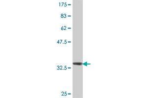 Western Blot detection against Immunogen (37. (UGT1A10 antibody  (AA 187-289))