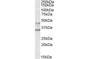 Western Blotting (WB) image for anti-Potassium Inwardly-Rectifying Channel, Subfamily J, Member 6 (KCNJ6) (C-Term) antibody (ABIN2465762) (KCNJ6 antibody  (C-Term))