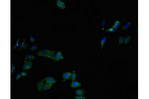 Immunofluorescent analysis of HepG2 cells using ABIN7147018 at dilution of 1:100 and Alexa Fluor 488-congugated AffiniPure Goat Anti-Rabbit IgG(H+L) (Cathepsin L antibody  (AA 114-288))