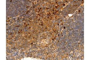 ABIN6264374 and ABIN6272975 at 1/100 staining Mouse thymus tissue by IHC-P.