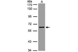 Western Blotting (WB) image for anti-Eukaryotic Translation Initiation Factor 3, Subunit D (EIF3D) antibody (ABIN2855038)