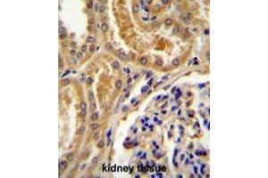 TLL2 Antibody (Center) immunohistochemistry analysis in formalin fixed and paraffin embedded human kidney tissue followed by peroxidase conjugation of the secondary antibody and DAB staining. (Tolloid-Like 2 antibody  (Middle Region))