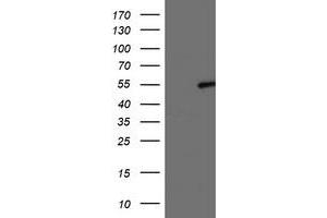 HEK293T cells were transfected with the pCMV6-ENTRY control (Left lane) or pCMV6-ENTRY LPL (Right lane) cDNA for 48 hrs and lysed. (Lipoprotein Lipase antibody  (AA 28-475))