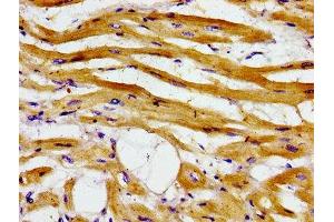 Immunohistochemistry of paraffin-embedded human heart tissue using ABIN7143334 at dilution of 1:100 (ADCY6 antibody  (AA 9-118))