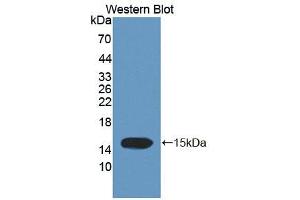 Western blot analysis of the recombinant protein. (Trichohyalin antibody  (AA 1851-1943))