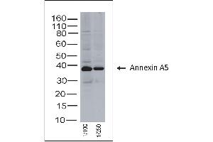 Rabbit anti Annexin A5 on human tonsil lysate (Annexin V antibody)
