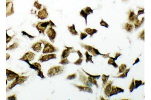 Anti-PDK2 antibody, ICC ICC: HELA Cell (PDK2 antibody  (C-Term))