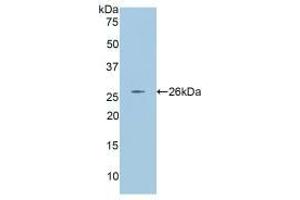 Western blot analysis of recombinant Rat ANGPT2.