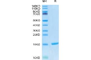 Cynomolgus S100A9 on Tris-Bis PAGE under reduced condition. (S100A9 Protein (AA 1-114) (His tag))