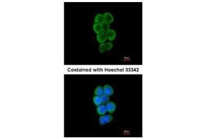ICC/IF Image Immunofluorescence analysis of methanol-fixed A431, using CBL, antibody at 1:50 dilution. (CBL antibody  (C-Term))