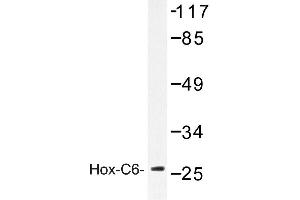 Image no. 1 for anti-Homeobox C6 (HOXC6) antibody (ABIN272159) (Homeobox C6 antibody)