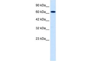 Western Blotting (WB) image for anti-Sodium Channel, Nonvoltage-Gated 1, beta (SCNN1B) antibody (ABIN2461078) (SCNN1B antibody)