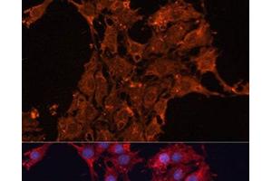 Immunofluorescence analysis of C6 cells using ADAM12 Polyclonal Antibody at dilution of 1:100. (ADAM12 antibody)