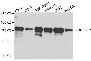 Western blot analysis of extracts of various cell lines, using IGF2BP3 antibody. (IGF2BP3 antibody  (AA 1-200))