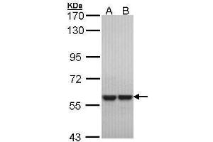 WB Image Sample (30 ug of whole cell lysate) A: Hela B: Hep G2 , 7.