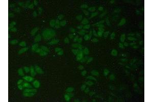 Detection of PFKP in Human Hela Cells using Polyclonal Antibody to Phosphofructokinase, Platelet (PFKP) (PFKP antibody  (AA 354-570))