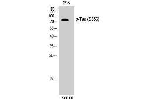 Western Blotting (WB) image for anti-tau Protein (pSer356) antibody (ABIN3182161) (tau antibody  (pSer356))