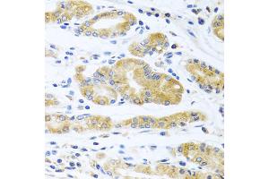 Immunohistochemistry of paraffin-embedded human stomach using ApoE antibody (ABIN5975768) at dilution of 1/100 (40x lens). (APOE antibody)