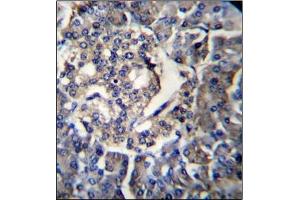 Immunohistochemistry analysis in Formalin Fixed, Paraffin Embedded Human pancreas tissue using RPL35 Antibody (C-term) followed by peroxidase conjugation of the secondary antibody and DAB staining. (RPL35 antibody  (C-Term))