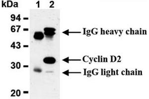 Western Blotting (WB) image for anti-Cyclin D2 (CCND2) antibody (ABIN487479) (Cyclin D2 antibody)